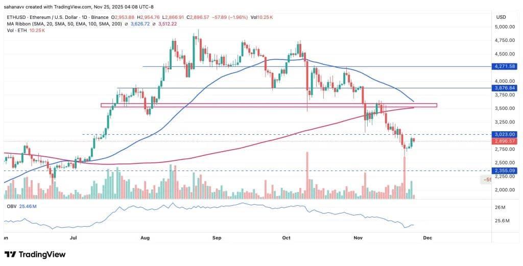 ETH 投资警报：短期回落风险增加